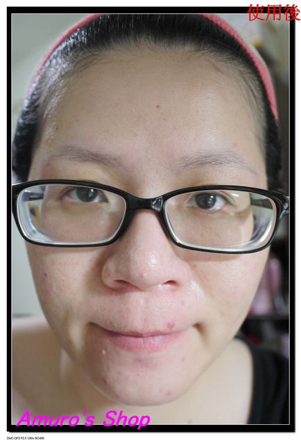  macy金縷梅爽膚淨荳面膜