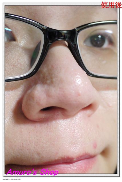  macy金縷梅爽膚淨荳面膜