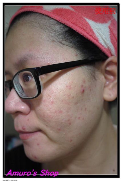  macy金縷梅爽膚淨荳面膜