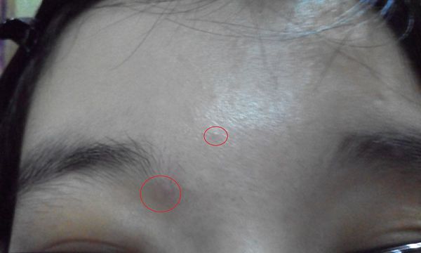  macy金縷梅爽膚淨荳面膜