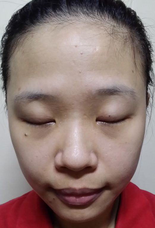  macy金縷梅爽膚淨荳面膜