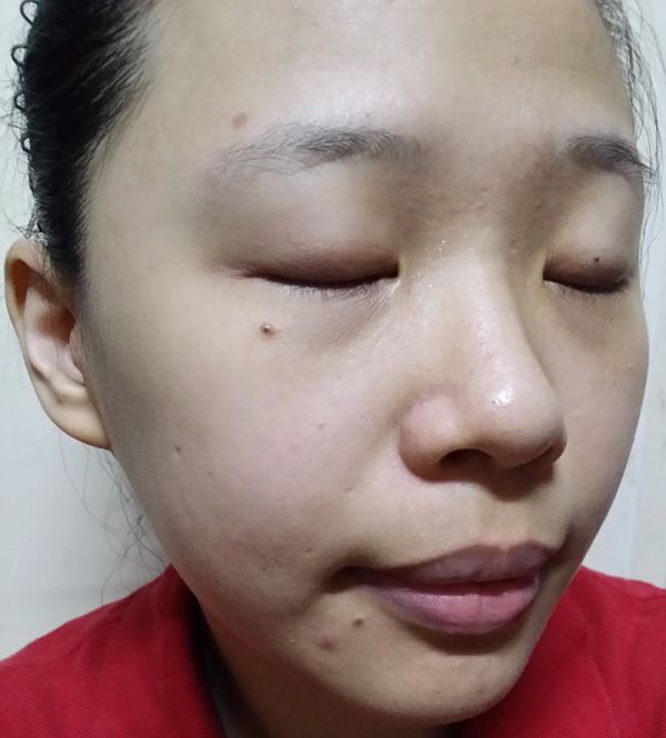  macy金縷梅爽膚淨荳面膜