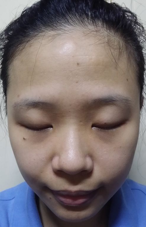  macy金縷梅爽膚淨荳面膜