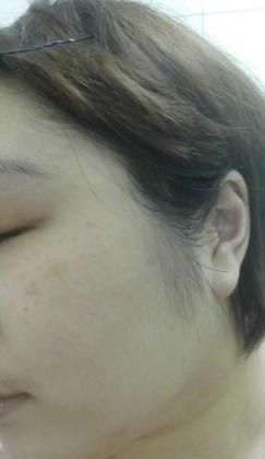  macy金縷梅爽膚淨荳面膜