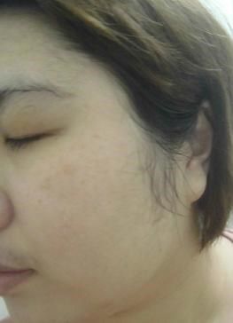  macy金縷梅爽膚淨荳面膜