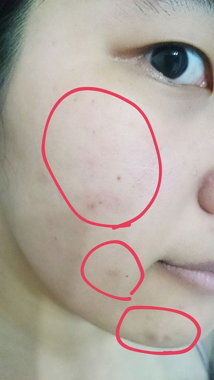  macy金縷梅爽膚淨荳面膜