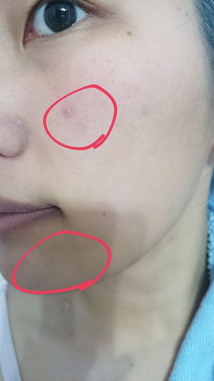  macy金縷梅爽膚淨荳面膜