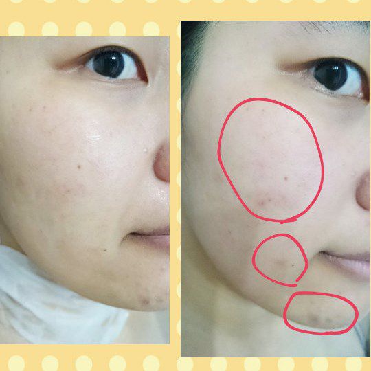  macy金縷梅爽膚淨荳面膜