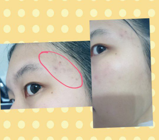  macy金縷梅爽膚淨荳面膜