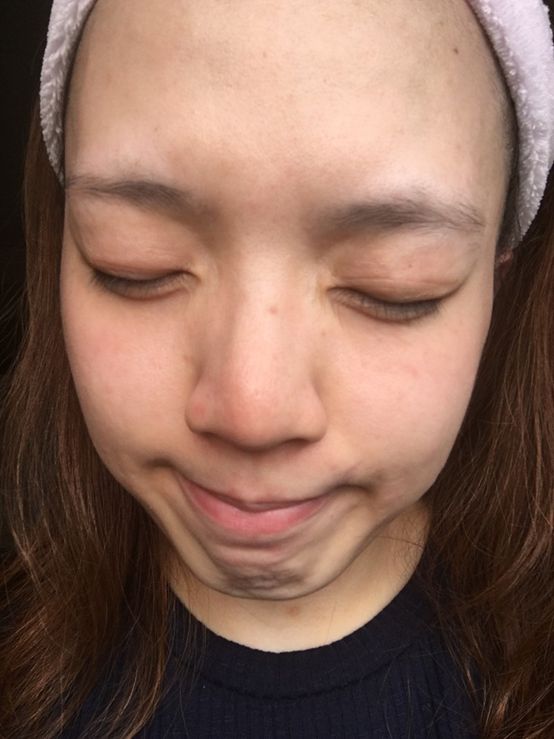  macy金縷梅爽膚淨荳面膜