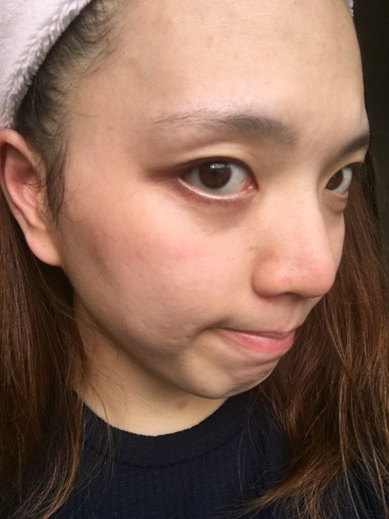  macy金縷梅爽膚淨荳面膜