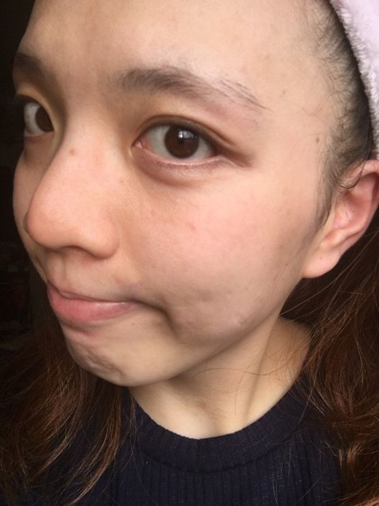  macy金縷梅爽膚淨荳面膜