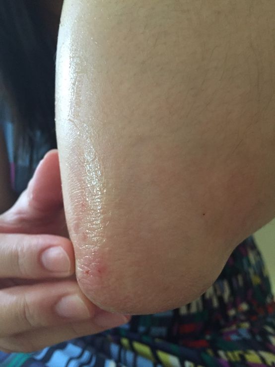  macy金縷梅爽膚淨荳面膜