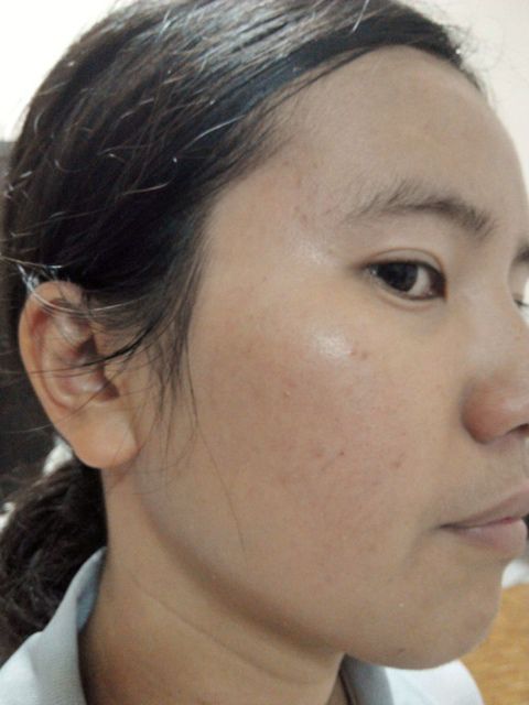 Hey蘋果肌女孩蕾絲拉提式面膜