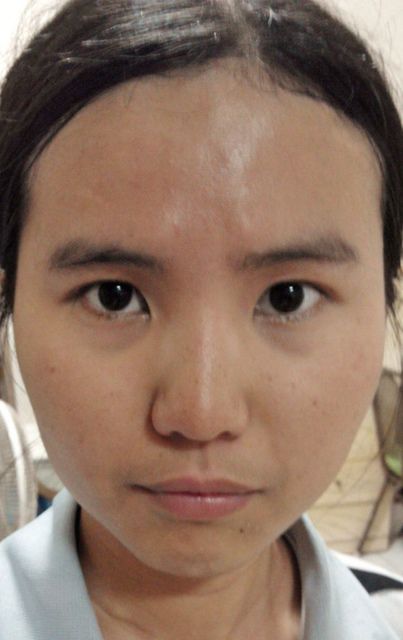 Hey蘋果肌女孩蕾絲拉提式面膜