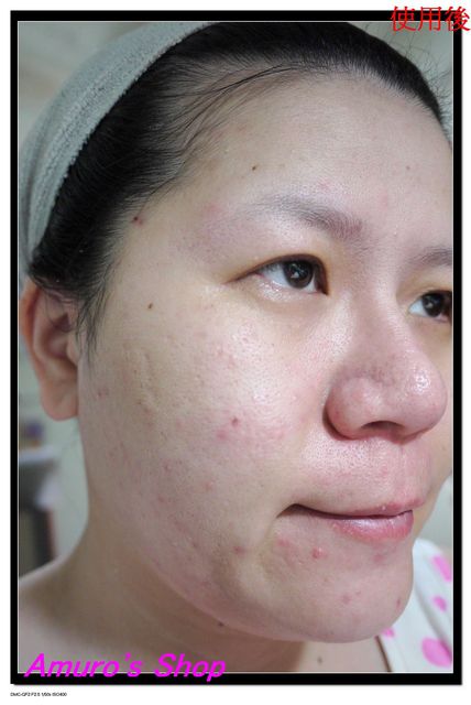 Hey蘋果肌女孩蕾絲拉提式面膜