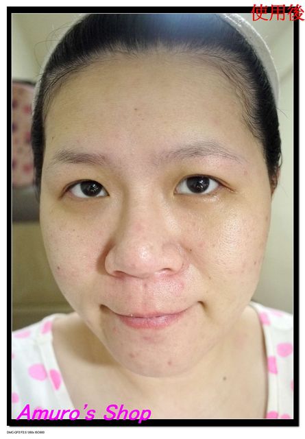 Hey蘋果肌女孩蕾絲拉提式面膜