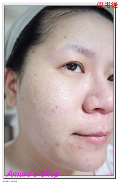 Hey蘋果肌女孩蕾絲拉提式面膜