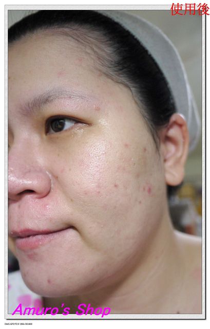 Hey蘋果肌女孩蕾絲拉提式面膜