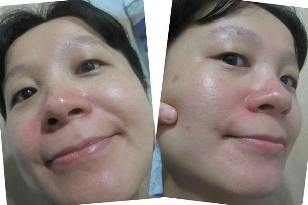 Hey蘋果肌女孩蕾絲拉提式面膜