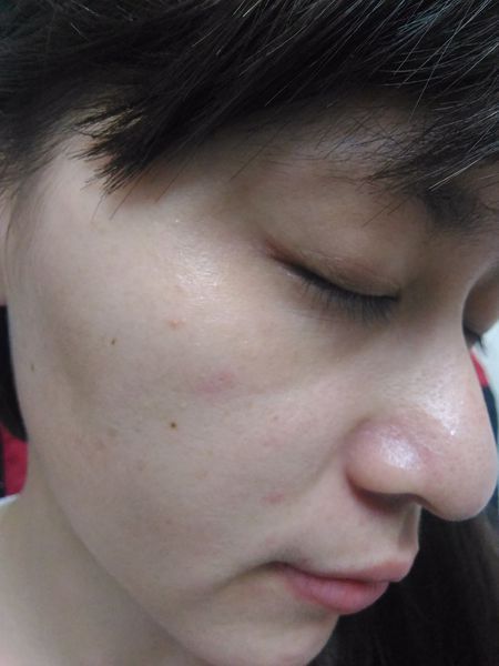 Hey蘋果肌女孩蕾絲拉提式面膜