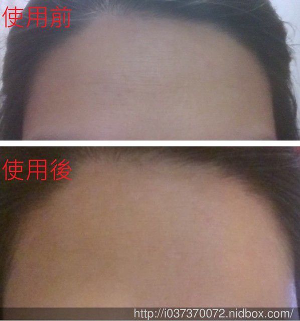 Hey蘋果肌女孩蕾絲拉提式面膜