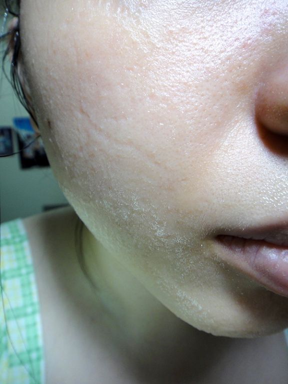 女人 知己 試用 大隊 Hey 蘋果肌 女孩 荷花 薏仁 淨白 緊緻 蕾絲 拉提式 面膜 chialo