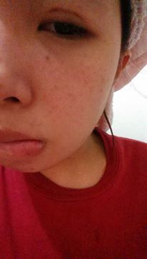 Hey蘋果肌女孩蕾絲拉提式面膜