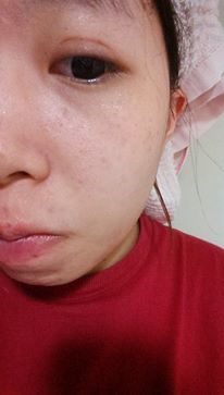 Hey蘋果肌女孩蕾絲拉提式面膜