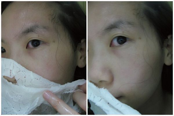 Hey蘋果肌女孩蕾絲拉提式面膜