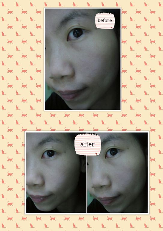 Hey蘋果肌女孩蕾絲拉提式面膜