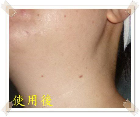 Hey蘋果肌女孩蕾絲拉提式面膜