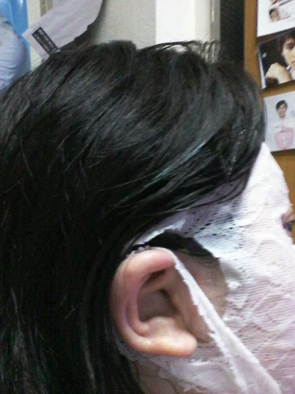 Hey蘋果肌女孩蕾絲拉提式面膜