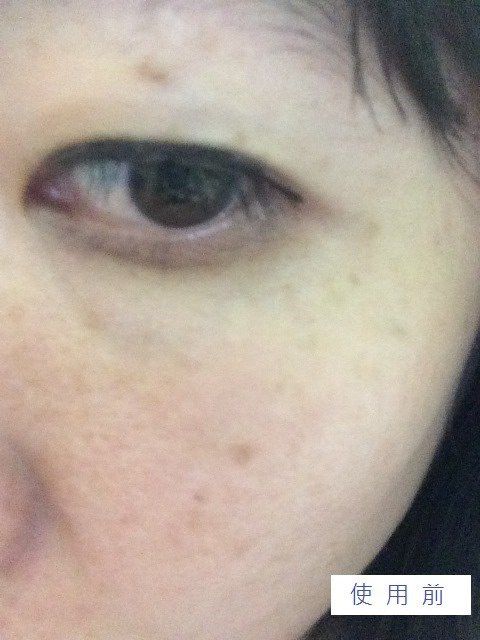 Hey蘋果肌女孩蕾絲拉提式面膜