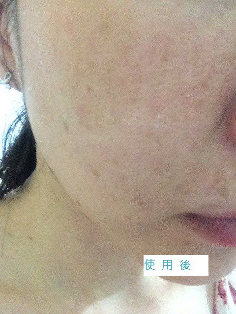 Hey蘋果肌女孩蕾絲拉提式面膜