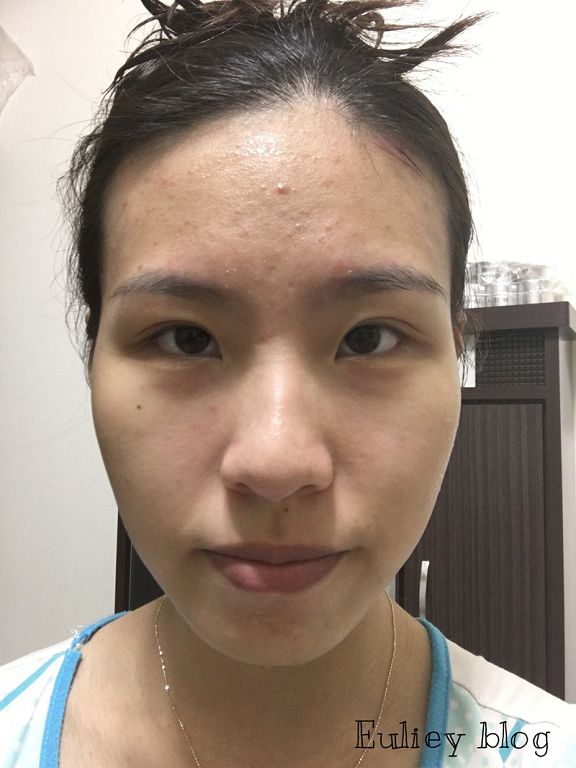 Hey蘋果肌女孩蕾絲拉提式面膜