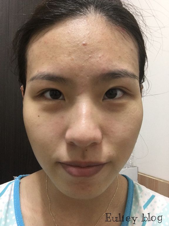 Hey蘋果肌女孩蕾絲拉提式面膜