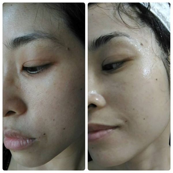 Hey蘋果肌女孩蕾絲拉提式面膜