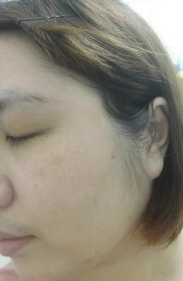 Hey蘋果肌女孩蕾絲拉提式面膜