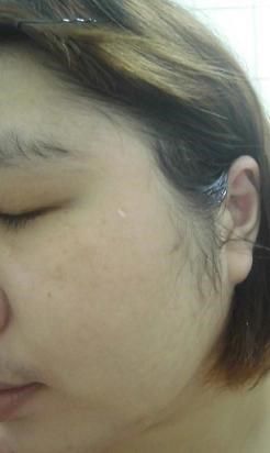 Hey蘋果肌女孩蕾絲拉提式面膜