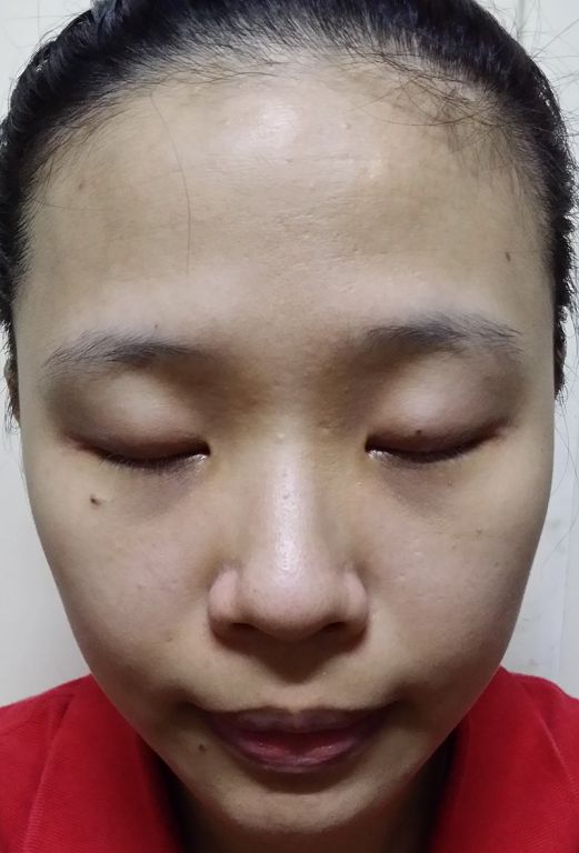 Hey蘋果肌女孩蕾絲拉提式面膜