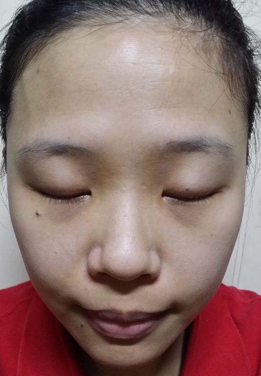 Hey蘋果肌女孩蕾絲拉提式面膜