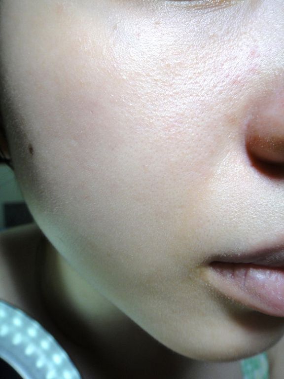 女人 知己 試用 大隊 Hey 蘋果肌 女孩 荷花 薏仁 淨白 緊緻 蕾絲 拉提式 面膜 chialo