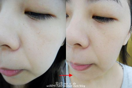 Hey蘋果肌女孩蕾絲拉提式面膜