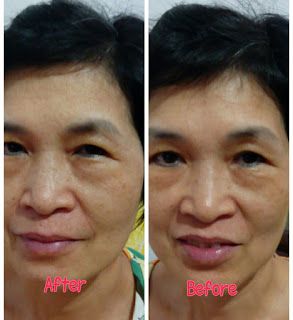 Hey蘋果肌女孩蕾絲拉提式面膜