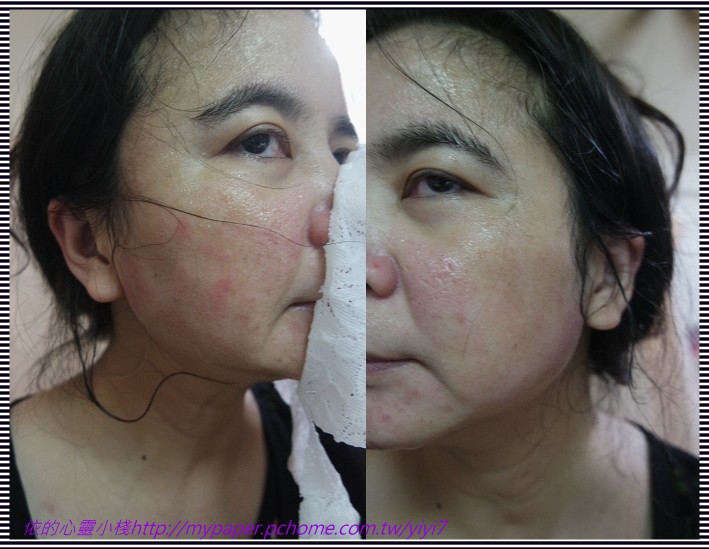 Hey蘋果肌女孩蕾絲拉提式面膜