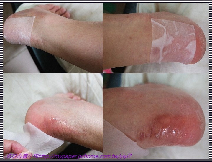 Hey蘋果肌女孩蕾絲拉提式面膜