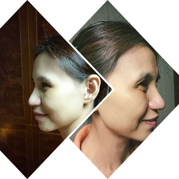 JM就是美台灣溫泉水面膜