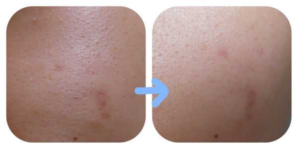 妍霓絲極淨透碳深層喚白黑凍膜