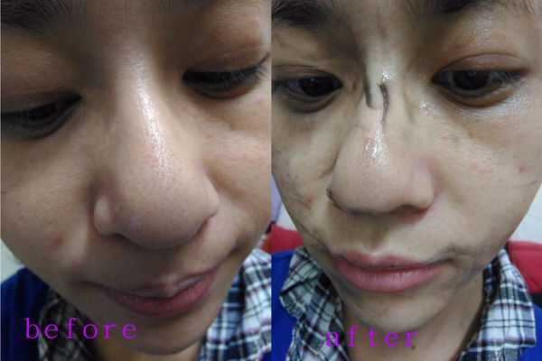 妍霓絲極淨透碳深層喚白黑凍膜